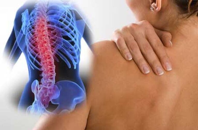 Pri osteohondrozi lahko bolečina seva v oddaljene dele telesa