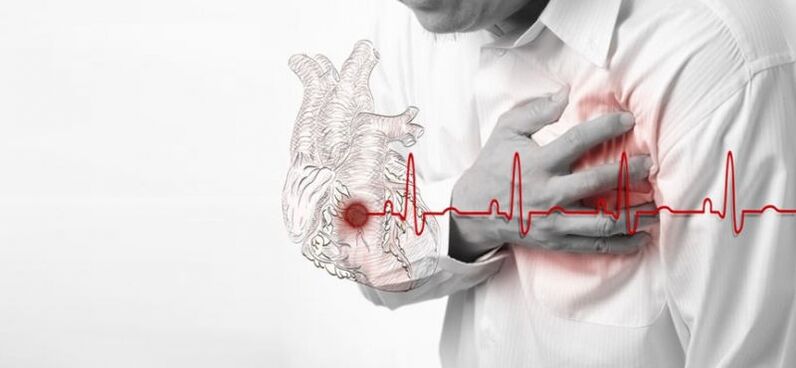 srčni infarkt kot vzrok bolečine pod levo lopatico