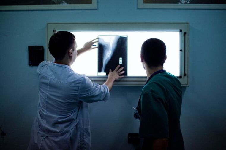 Diagnoza artroze na x -ray
