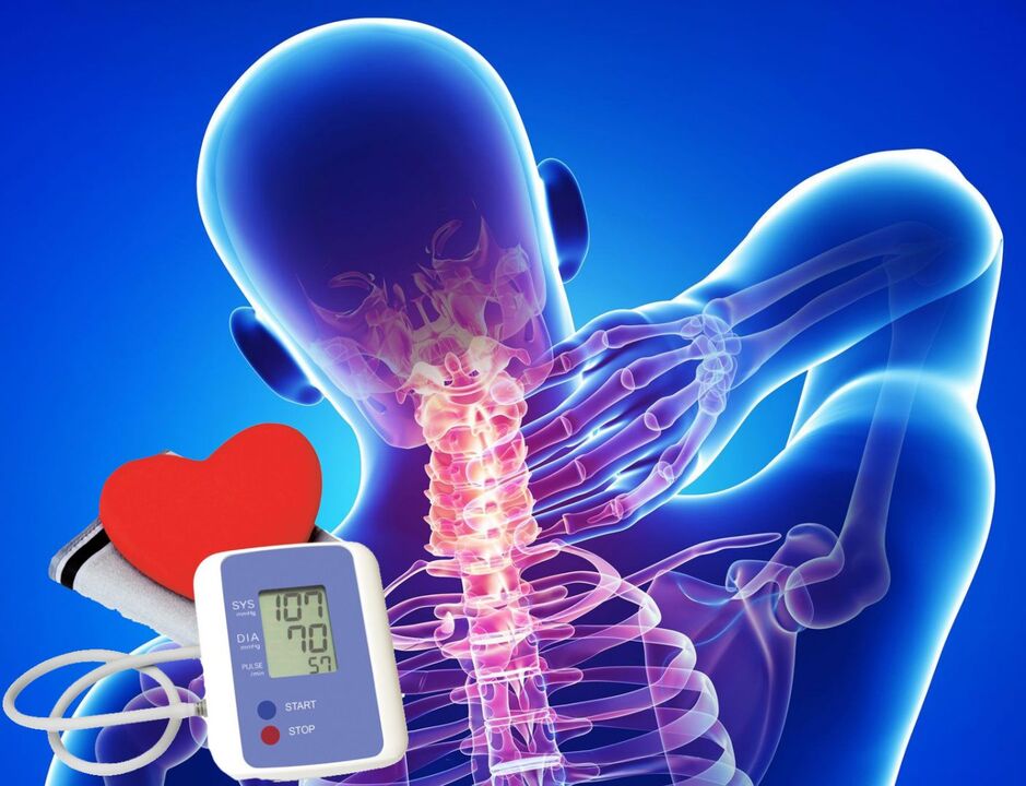 Skoki krvnega tlaka s cervikalno osteohondrozo