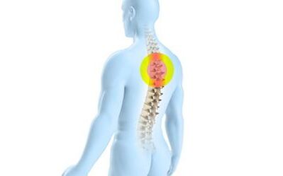 osteohondroza torakalne hrbtenice