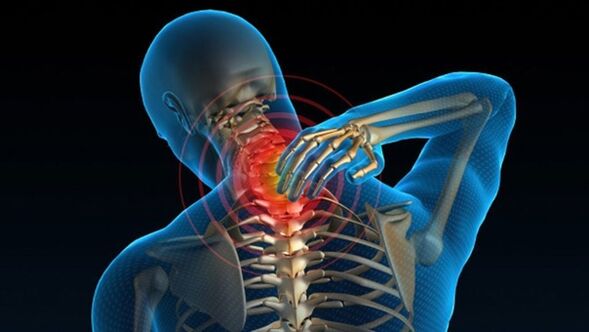 Bolečina pri obračanju vratu lahko kaže na sindrom vretenčne cervikalne osteohondroze