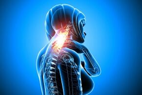 osteohondroza v vratni hrbtenici